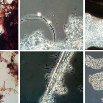 Filamentous Microorganism Evaluation
